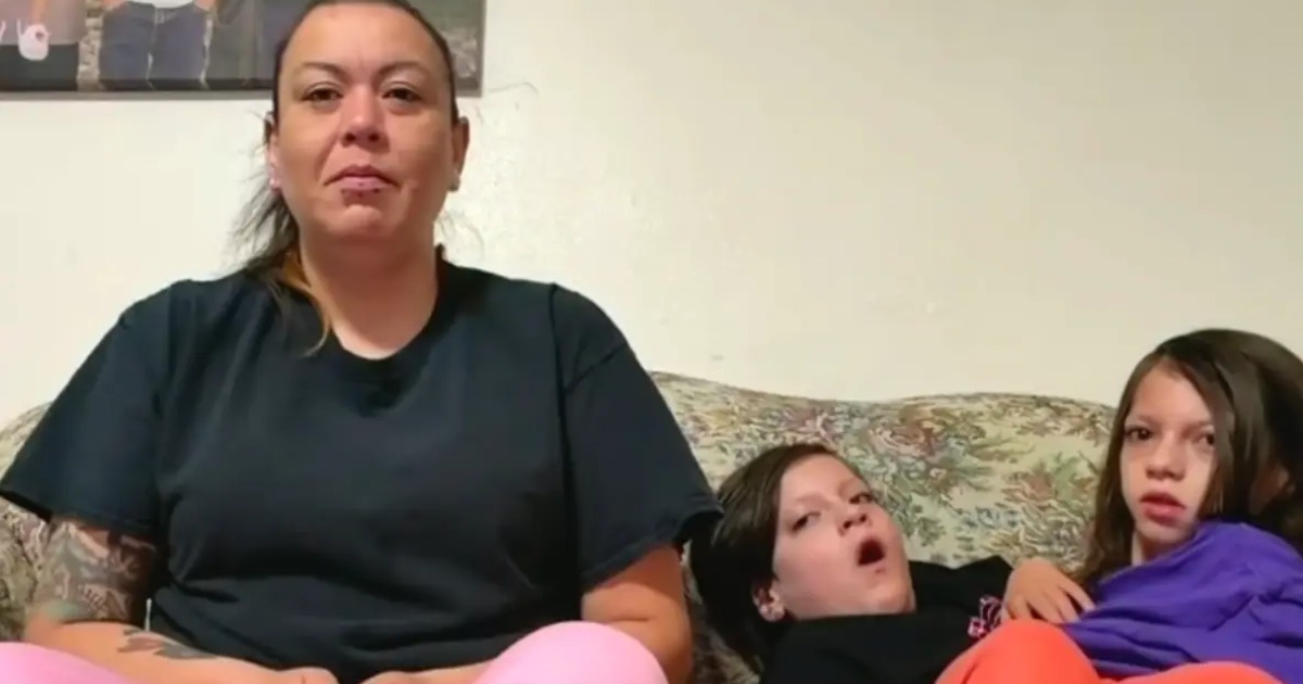 Mother of conjoined twins given 24 hours to live reveals why she refused to separate them